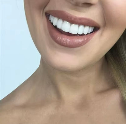 Carillas dentales 🦷