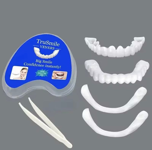 Carillas dentales 🦷