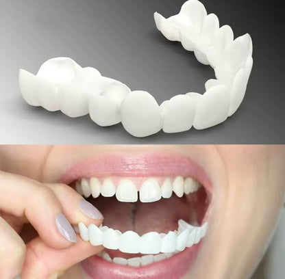 Carillas dentales 🦷